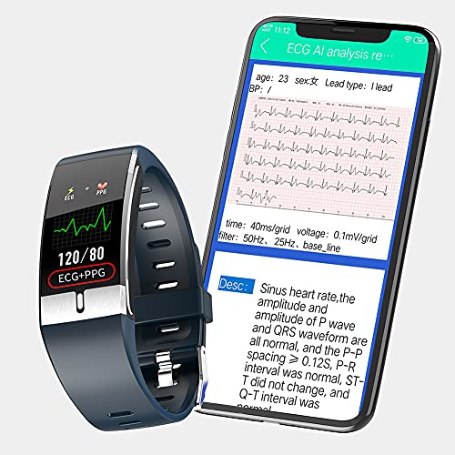 DigiKuber Temperatura Corporea Smartwatch Uomo ECG Orologio Intelli...